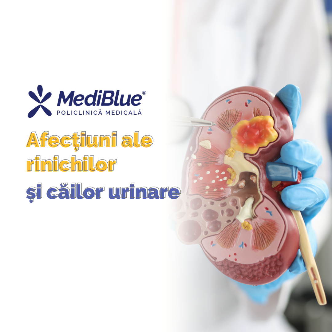Afecțiunile rinichilor: Importanța controalelor regulate Afecțiunile rinichilor: Importanța controalelor regulate