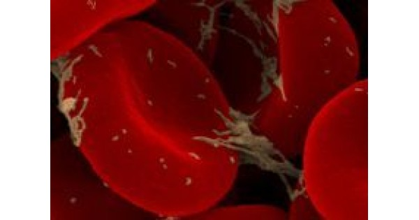 Subțierea sângelui: Remedii naturale esențiale Subțierea sângelui: Remedii naturale esențiale