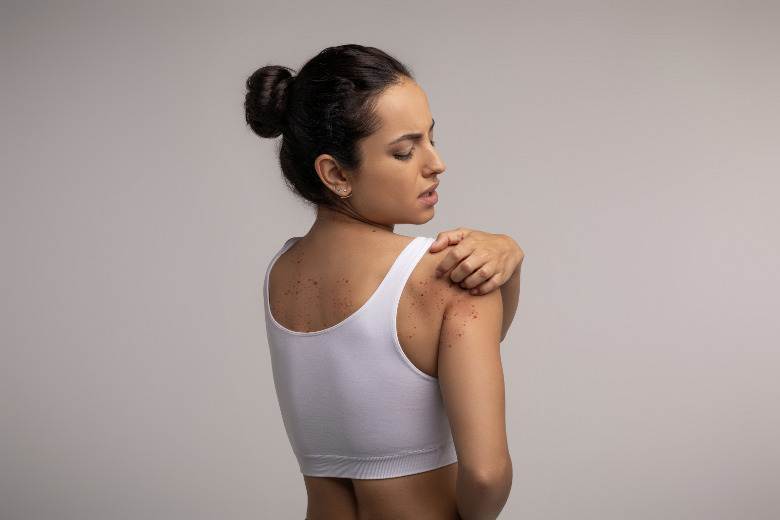 Patru semne ale pielii care pot indica o boală hepatică, potrivit unui medic gastroenterolog