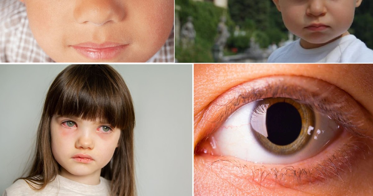 Privirea copilului tău îți poate spune mai multe decât crezi: ce boli grave poți depista din ochi Privirea copilului tău îți poate spune mai multe decât crezi: ce boli grave poți depista din ochi