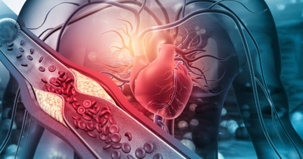 Colesterolul redus într-o săptămână. Cinci pași recomandați de nutriționiști Colesterolul redus într-o săptămână. Cinci pași recomandați de nutriționiști