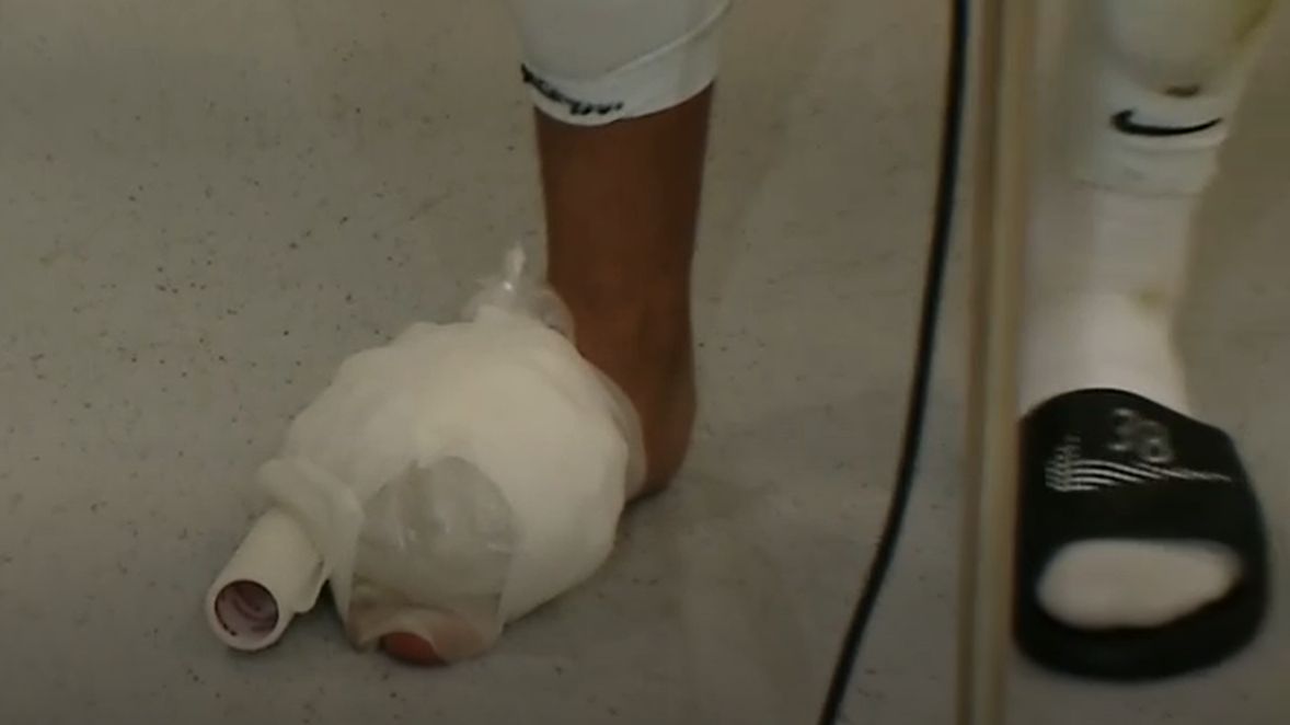 Imagini horror cu piciorul lui Mihai Lixandru. Cum a venit fotbalistul la flash-interviu