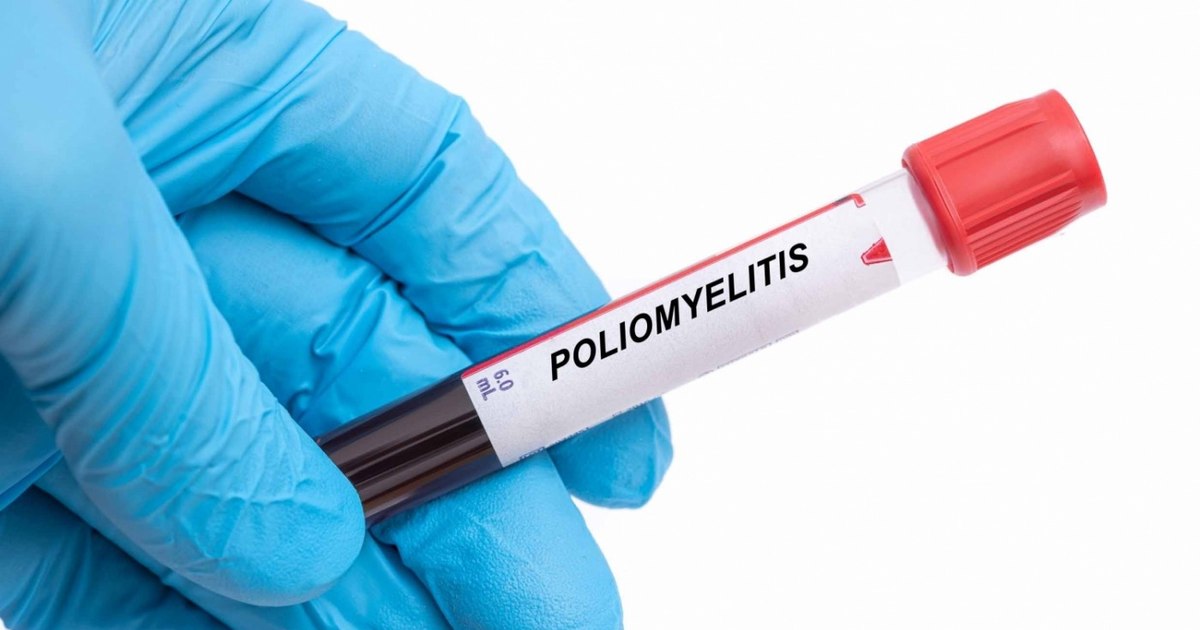 Ce nu știi despre bolile pentru care există vaccin. Afecțiunea cu risc de deces la 1 din 10 pacienți, chiar și cu tratament Ce nu știi despre bolile pentru care există vaccin. Afecțiunea cu risc de deces la 1 din 10 pacienți, chiar și cu tratament