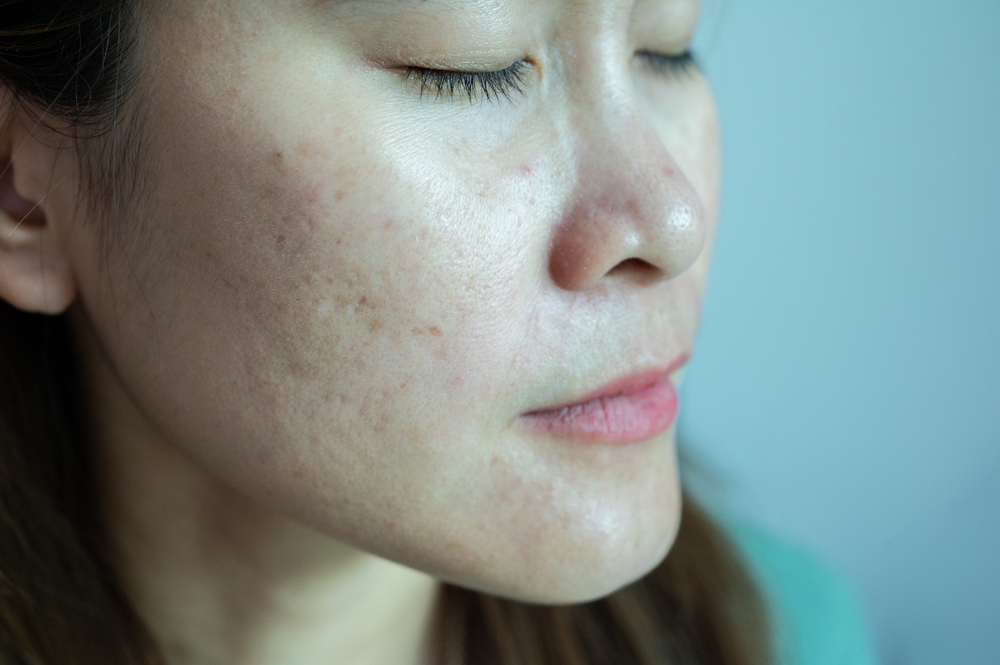„Rutina de îngrijire trebuie să fie cât mai puțin complicată. Nu vă lăsați furați de mirajul din social-media”. Sfaturi aplicate de la dermatolog