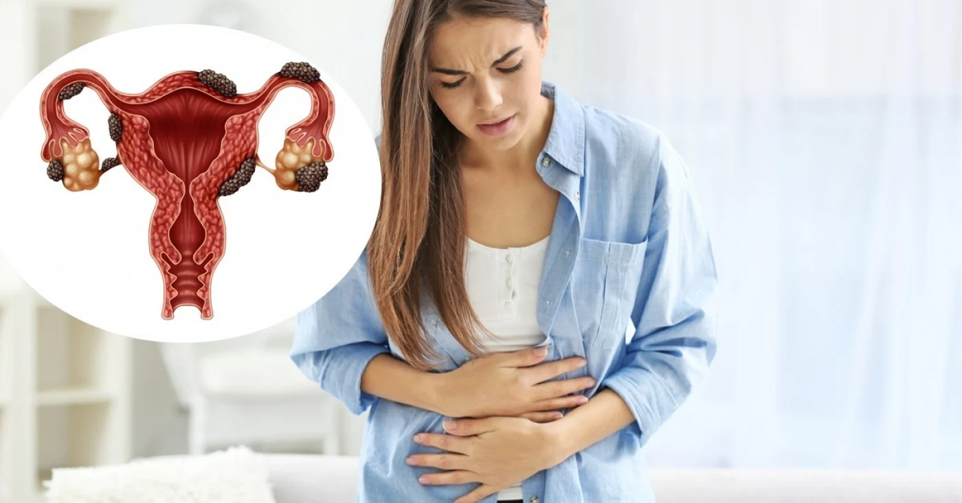Boala se poate agrava și se poate ajunge la cancer de endometru